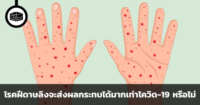 การระบาดของฝีดาษลิงจะส่งผลกระทบได้มากเท่าโควิด-19 หรือไม่